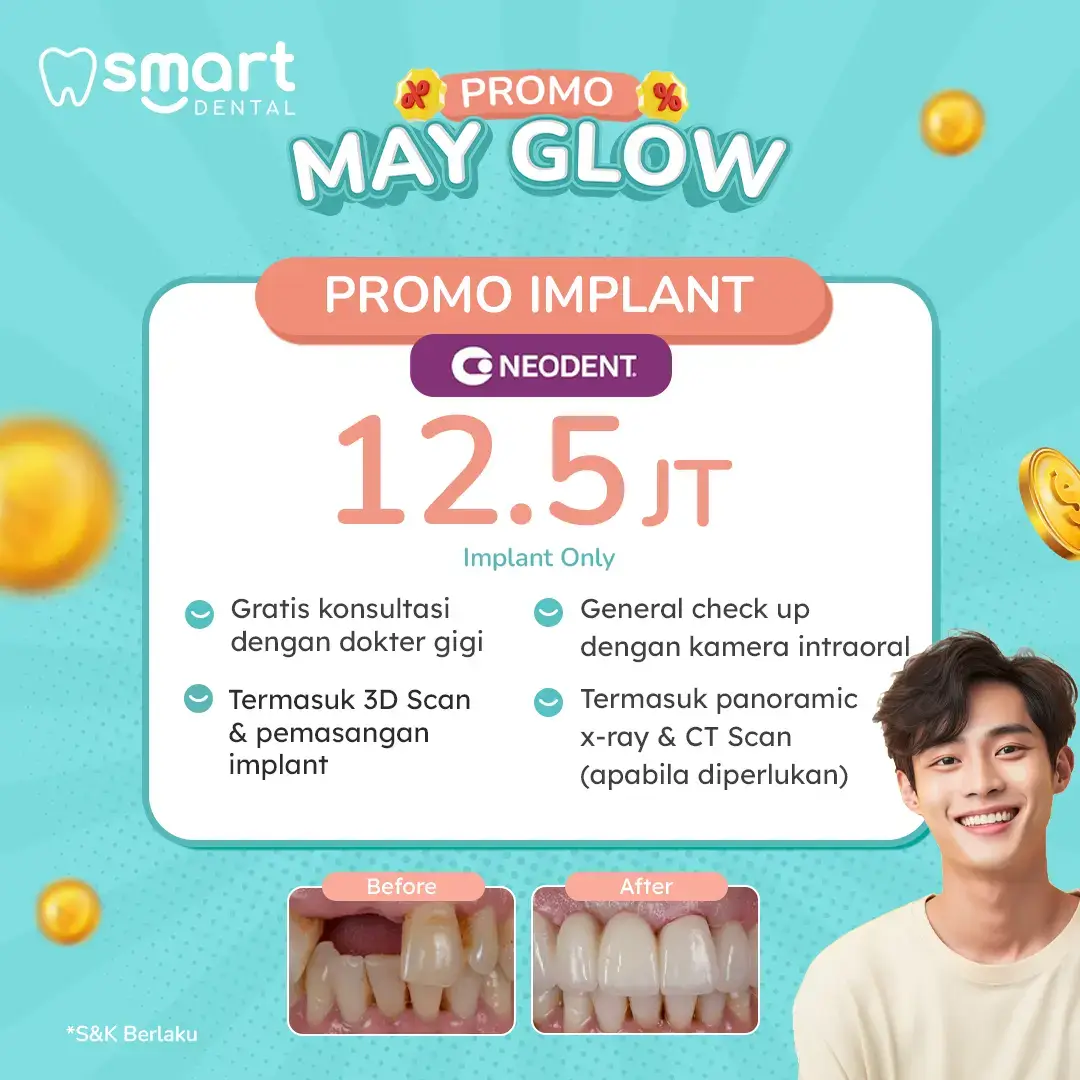 PROMO IMPLANT MEI 2025