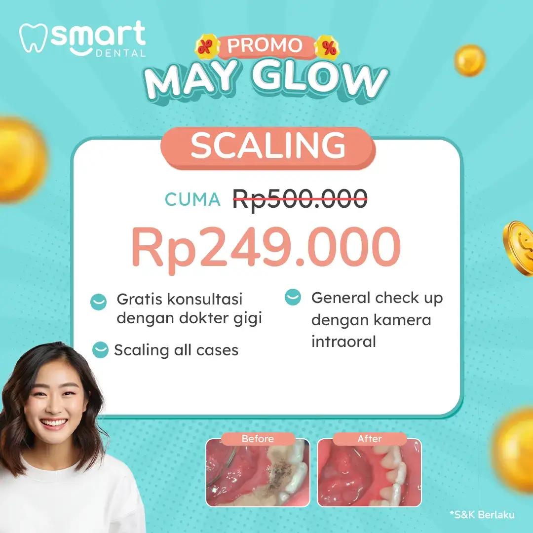 PROMO SCALING MEI 2025